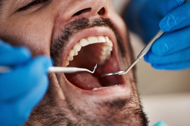Best Emergency Root Canal Therapy in Boonville, IN