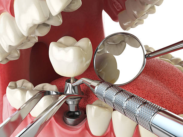 Best Walk-In Emergency Dental Services in Boonville, IN